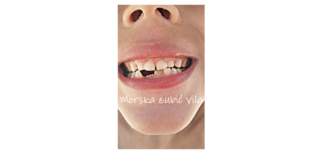 Morska-zubic-vila2